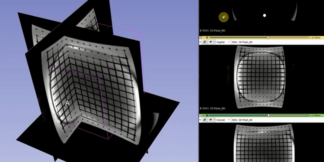 黃金標(biāo)準(zhǔn)X射線乳腺攝影對比度細(xì)節(jié)模體CDMAM 3.4